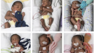 Kogi Woman Gives Birth to Sextuplets